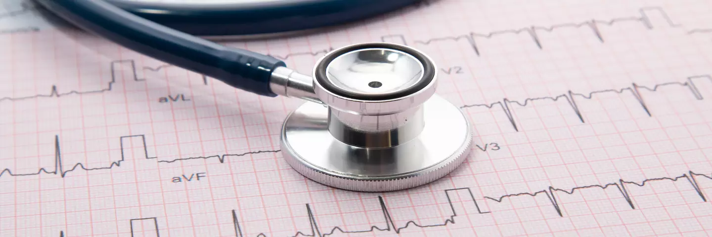 Ein Stethoskop liegt auf einem gedruckten EKG-Diagramm.