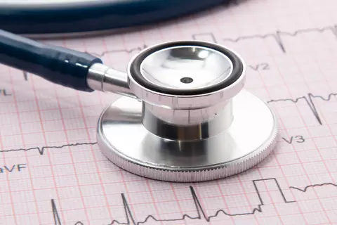 Ein Stethoskop liegt auf einem gedruckten EKG-Diagramm.